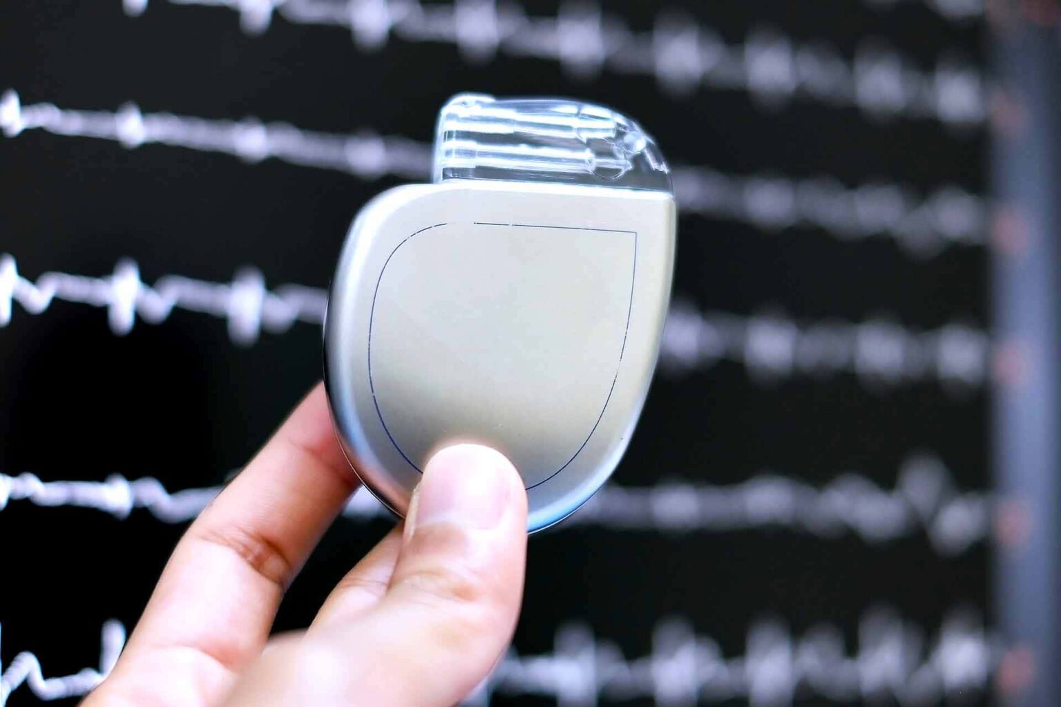 Defibrillatore impiantabile ICD